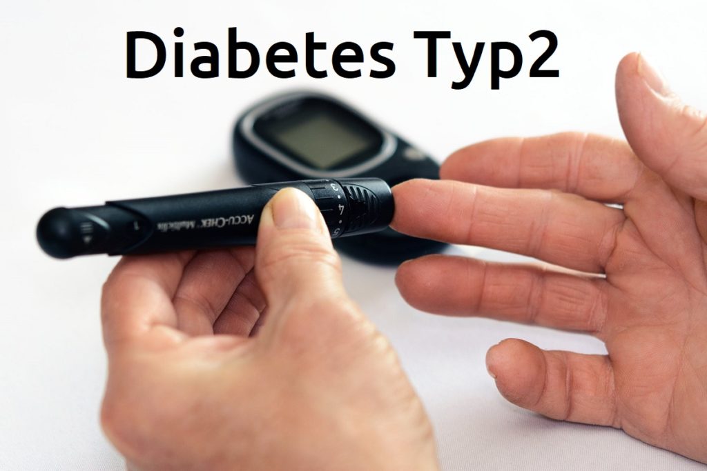 Diabetes Typ 2 – Ursachen Risikofaktoren Diagnose Behandlung Und ...